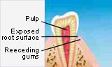 sensitiveteeth1